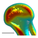 The distribution of bone density of the proximal femur with warm colors indicating higher bone density and cool colors indicating lower bone density.&nbsp;