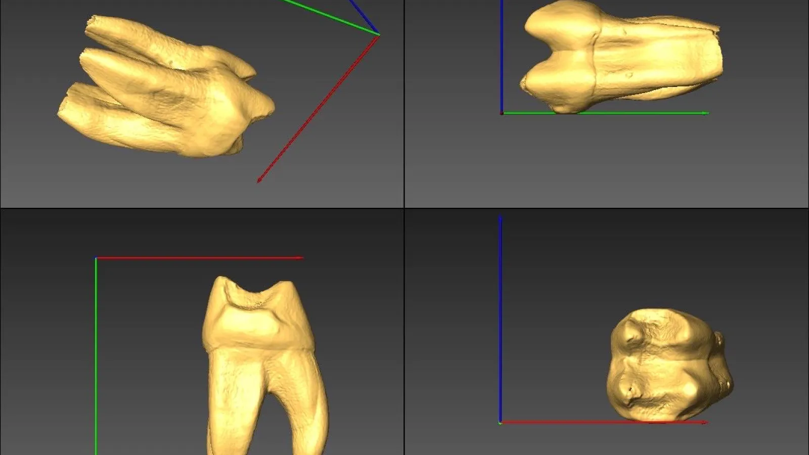 four angles of a tooth from micro-CT 