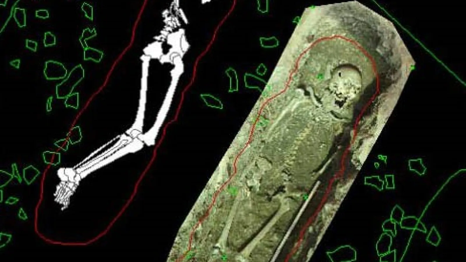 Cholera Lecture image