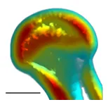 The distribution of bone density of the proximal femur with warm colors indicating higher bone density and cool colors indicating lower bone density.&nbsp;
