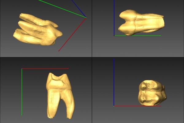 four angles of a tooth from micro-CT 