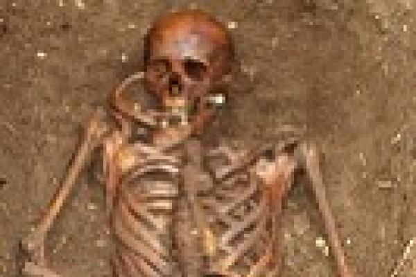 Head and upper torso of skeleton