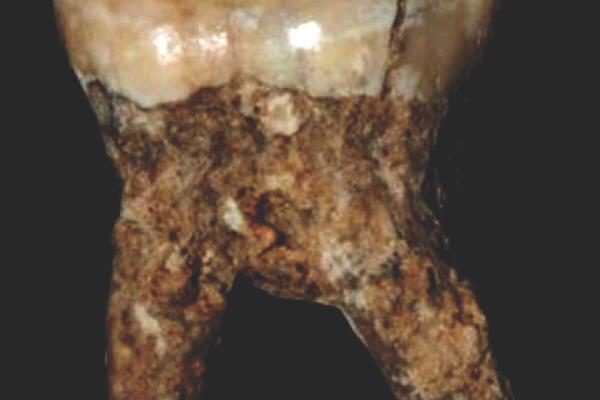 Fossil tooth Fossil tooth